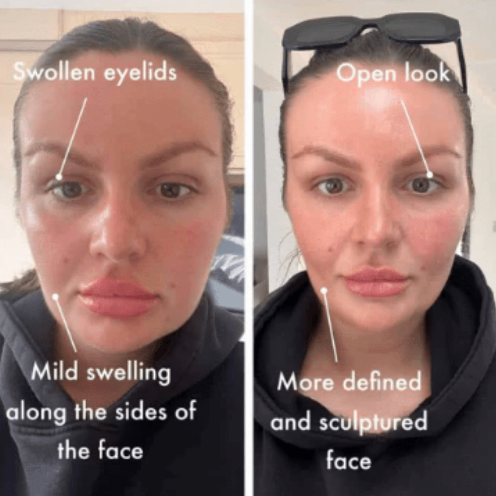 Clara Contour Lymphatic Brush